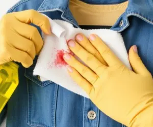 از بین بردن لکه از روی لباس